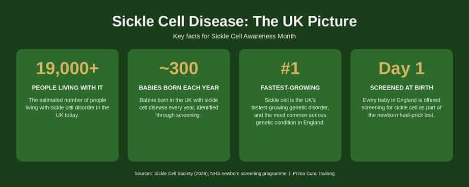 Infographic showing four UK sickle cell statistics: over 19,000 people living with sickle cell disorder, around 300 babies born with it each year, its status as the UK's fastest-growing genetic disorder, and newborn screening via the heel-prick test on day one of life.